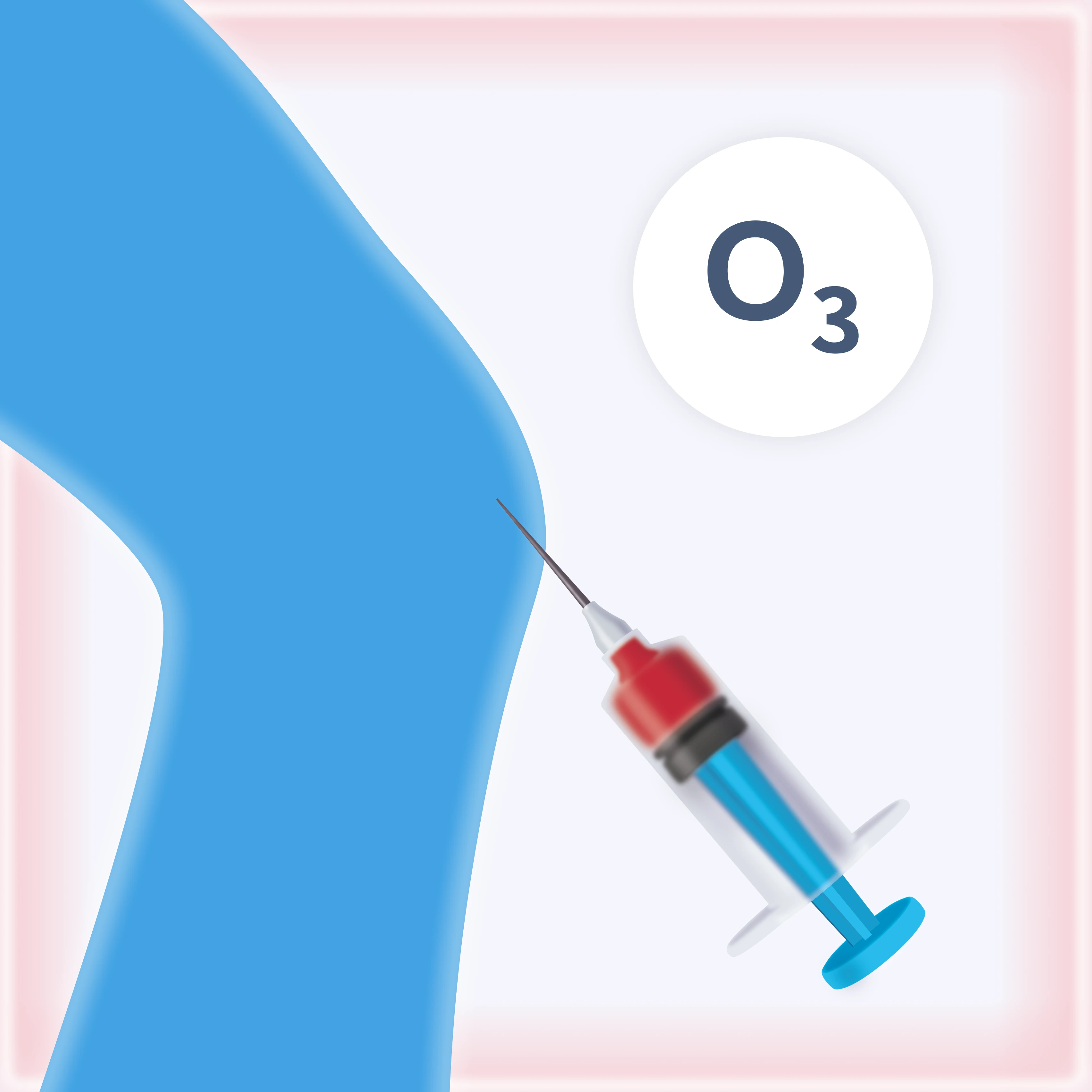 Intramuscular Ozone Therapy
